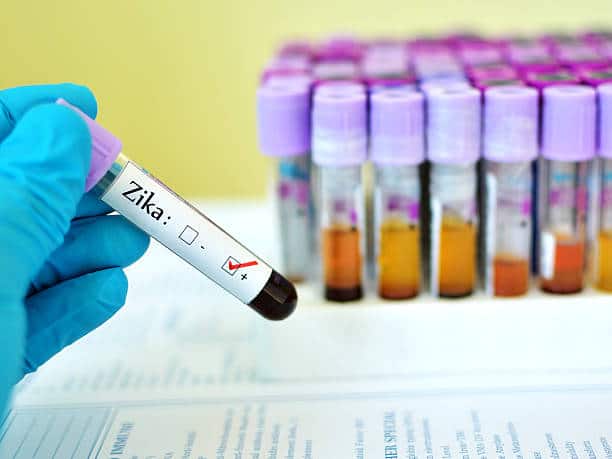 Le virus Zika : qu’en savez-vous ?